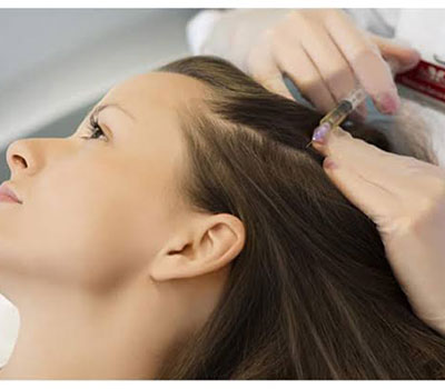 Stem Cell Mesotherapy for Hair Loss in Kurnool. Best Hair Specialist.